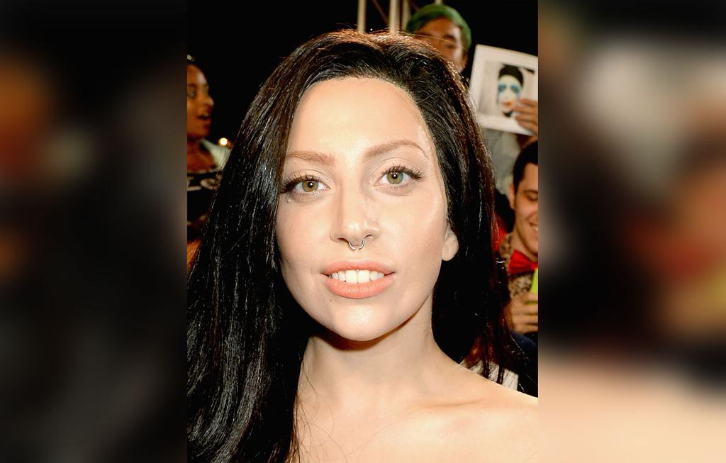 Lady Gaga's Plastic Surgery Makeover Exposed By Top Docs