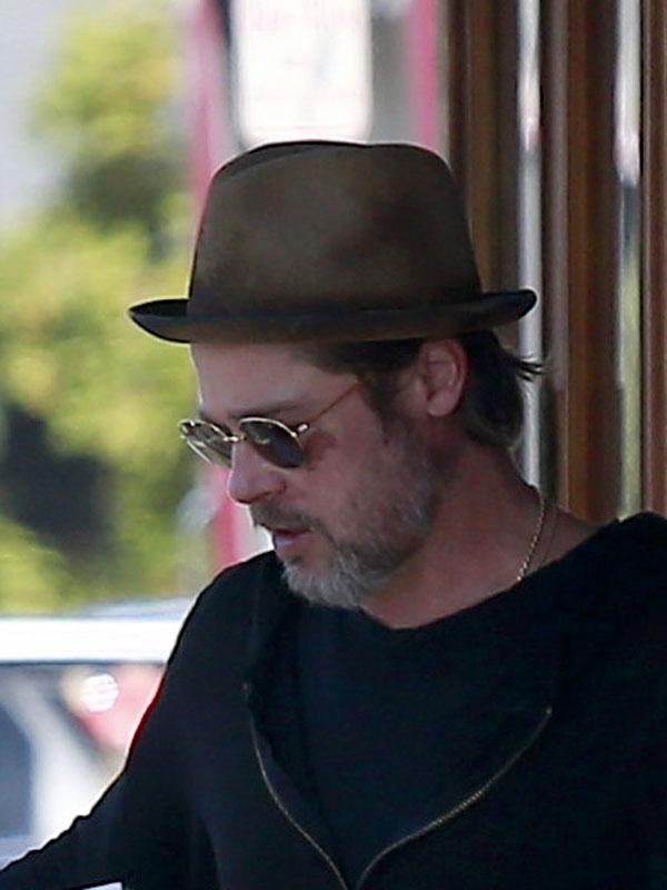 Brad Pitt Bruised Face