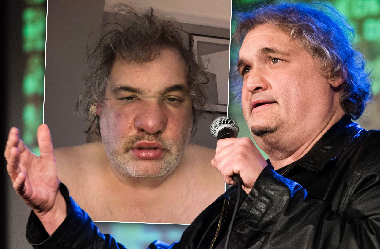 artie lange zayıflama