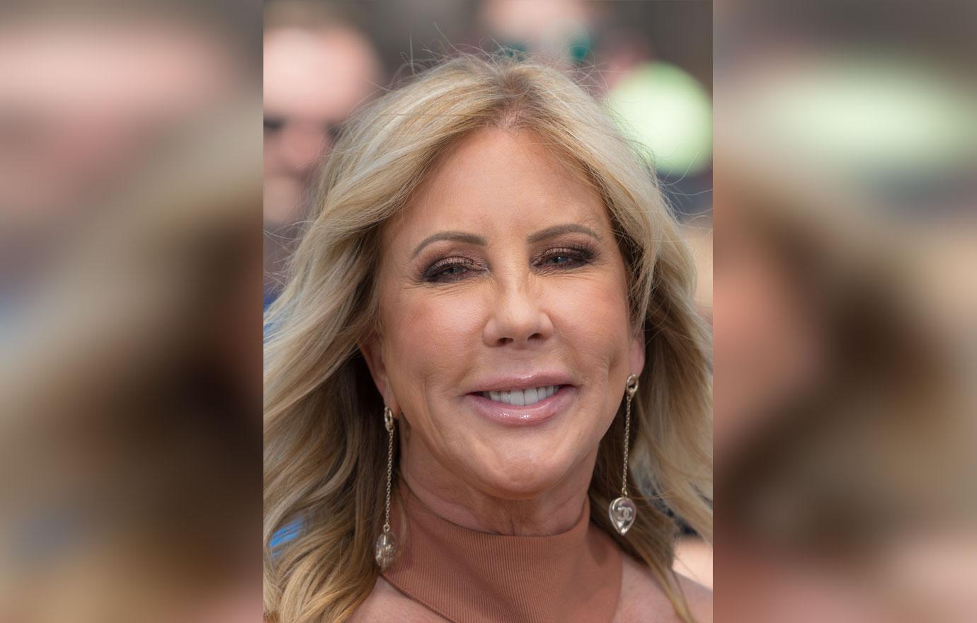 Vicki Gunvalson Plastic Surgery Face