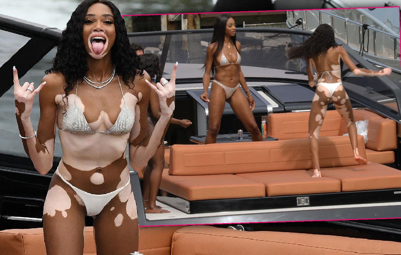 Winnie Harlow Flaunts Curves On Yacht In Miami