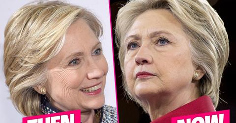 Hillary Clinton Plastic Surgery