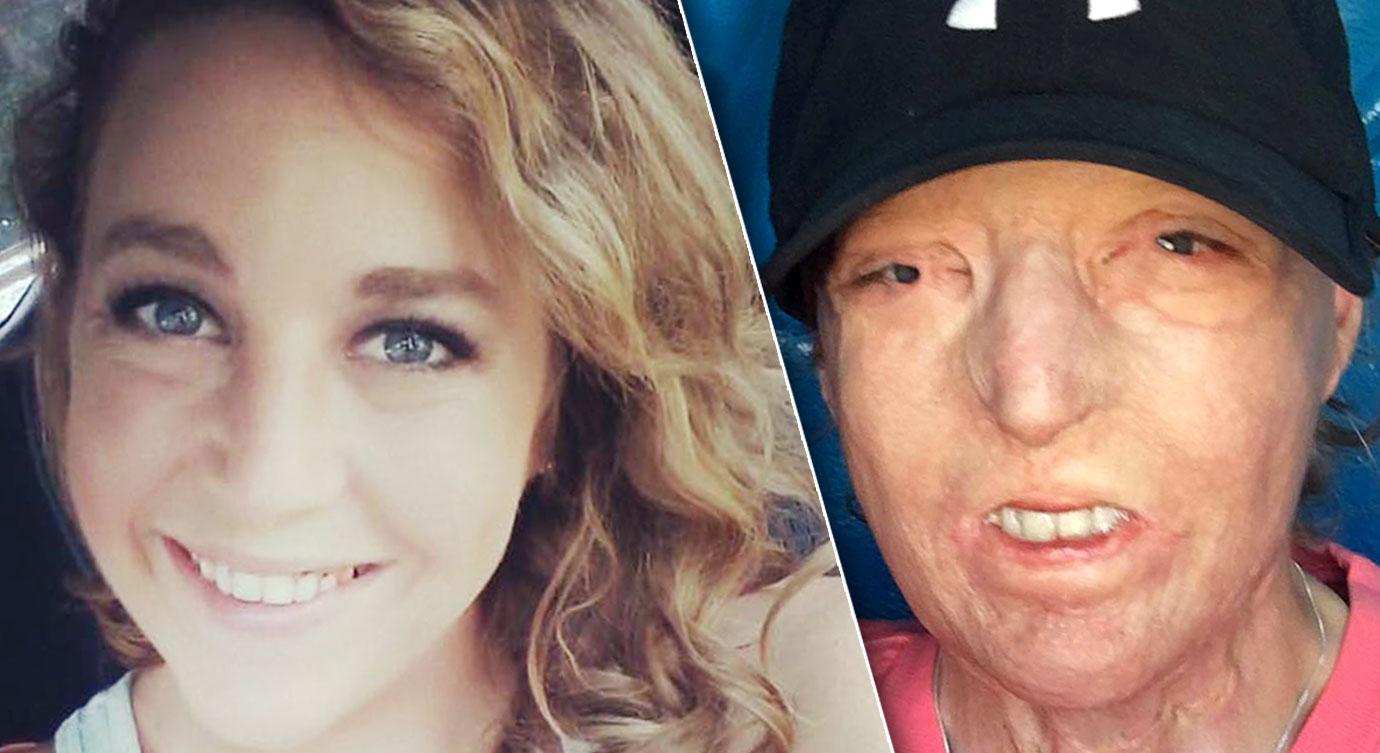 Burn Victim Courtney Waldon's Mom Slams Monster Husband Who Left Her
