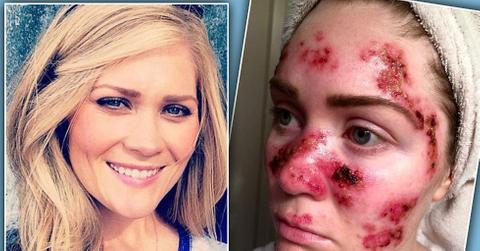 //tawny willoughby skin cancer selfie facebook