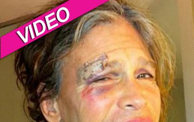 //steventylertodayshowteeth