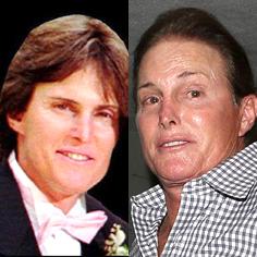 //male celeb plas srug