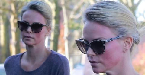 charlize theron face nasty welts facial procedure