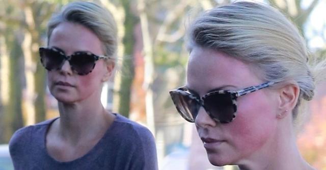 charlize theron face nasty welts facial procedure