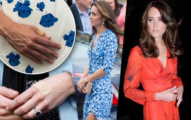 Kate Middleton Bulimia Rumors -- Princess Sparks Concern Over Photos