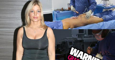 //Donna Derrico Baywatch Plastic Surgery Lipo Tummy Tuck Before pp