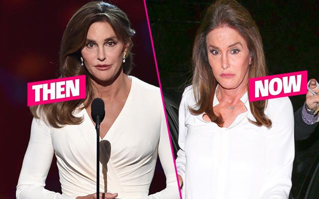 Caitlyn Jenner Plastic Surgery