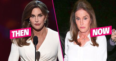 Caitlyn Jenner Plastic Surgery