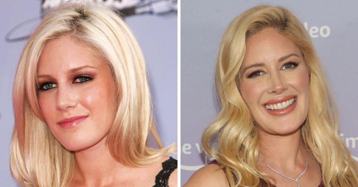 Celebrities Who Admitted To Getting A Nose Job Ashley Tisdale & More