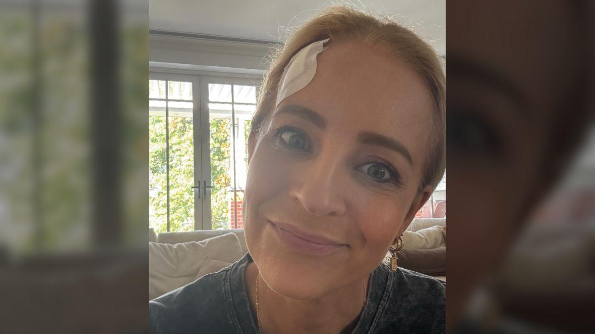 image of Doctors later told her the wound was so deep it would require plastic surgery.