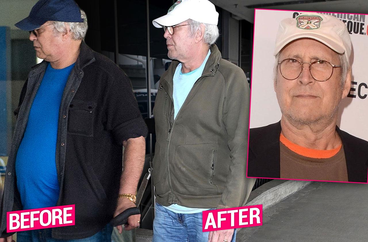 Chevy Chase Comic Legend Loses 100 Pounds Through Surgery And Rehab