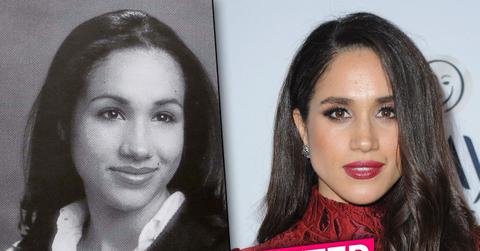 //Meghan Markle Nose Job pp