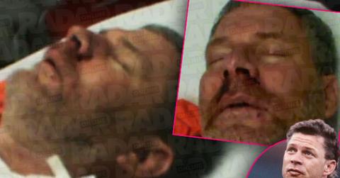 //lenny dykstra jail beating teeth knocked out video pp