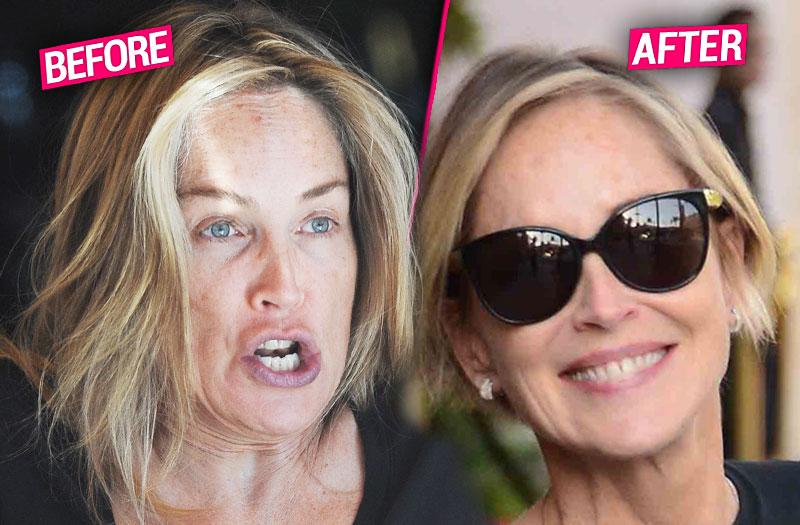 sharon stone botox plastic surgery rumors