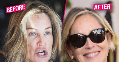 sharon stone botox plastic surgery rumors
