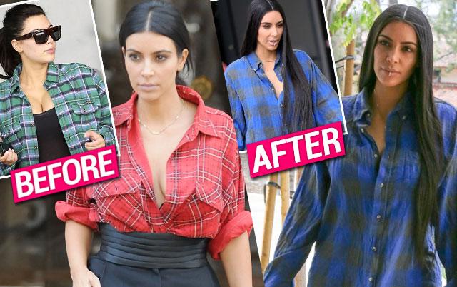 kim kardashian breast reduction Image 6