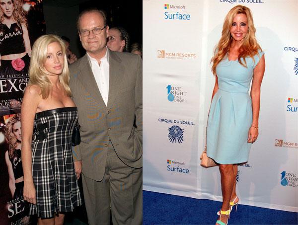 //real housewives plastic surgery secrets revealed