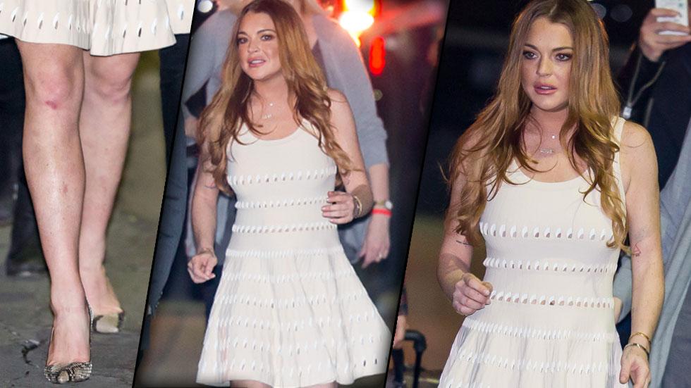 //lindsay lohan jimmy kimmel fox lawsuit