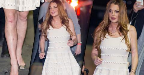 //lindsay lohan jimmy kimmel fox lawsuit
