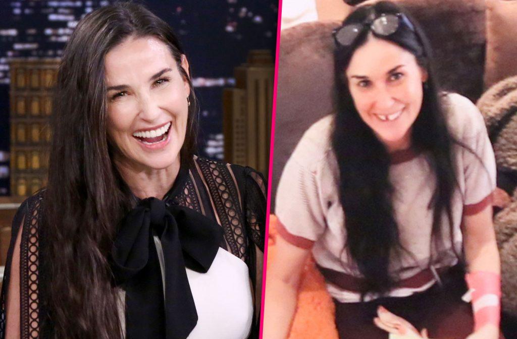 //demi moore missing teeth pics PP