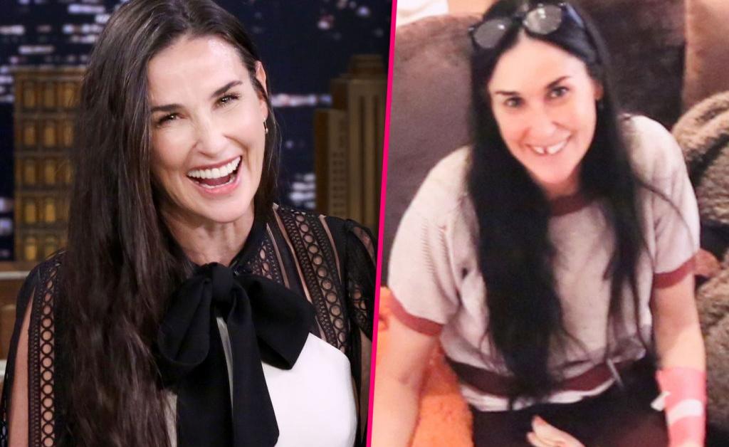 [PHOTOS] Demi Moore is missing her front teeth