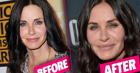 //Courtney Cox Plastic Surgery pp