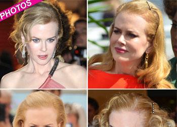 //nicole kidman frozen forehead cannes