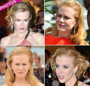 //nicole kidman frozen forehead cannes
