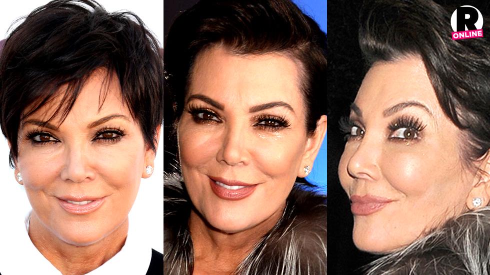 Plastic Fantastic Surgeon Claims Kris Jenner Used Botox Injections   Kris Jenner Plastic Surgeries Photos PP 