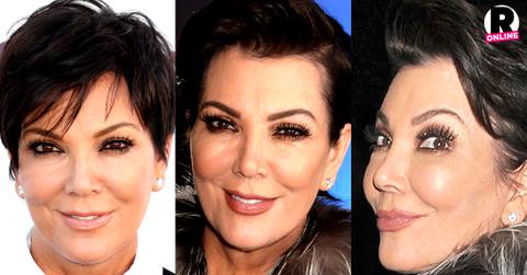 Kris Jenner Plastic Surgeries Photos