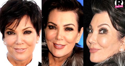 Plastic Fantastic! Surgeon Claims Kris Jenner Used Botox, Injections