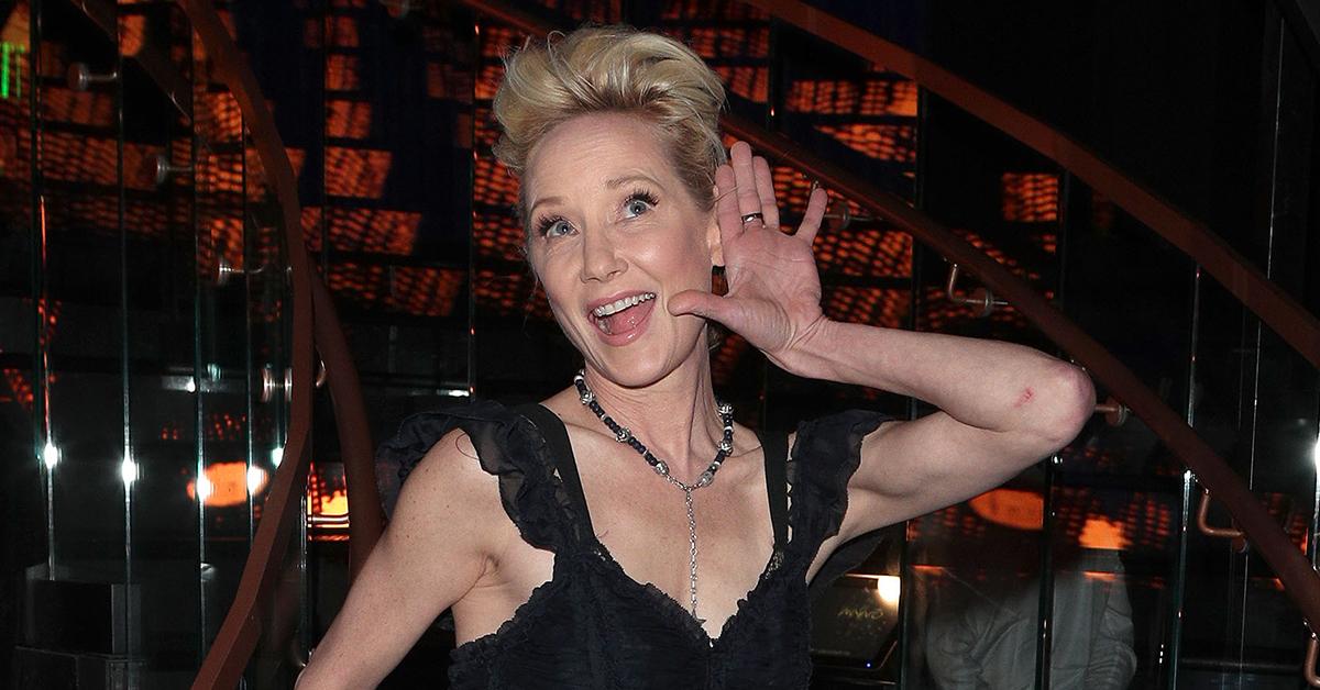 anne heche hospitalized burned fire car crash