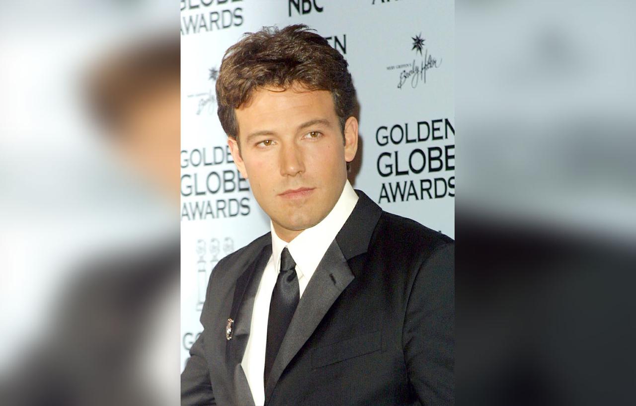 Ben Affleck Hairline Grabs Attention As Jennifer Lopez Romance Rumors Swirl