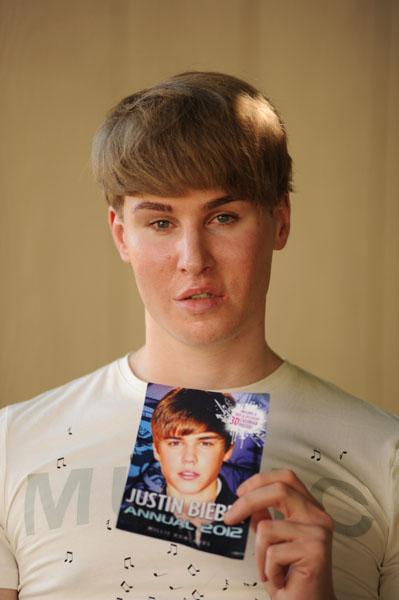 Toby Sheldon Has Plastic Surgery To Look Like Justin Bieber.