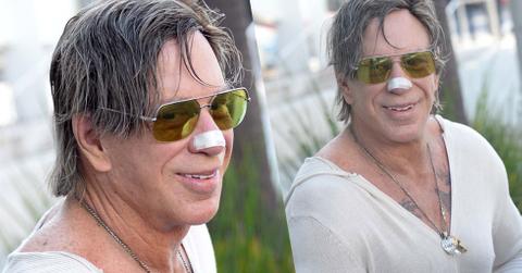 Mickey Rourke Plastic Surgery Photos