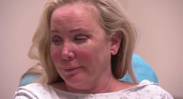 RHOC S Shannon Beadors Plastic Surgery Facelift Revealed