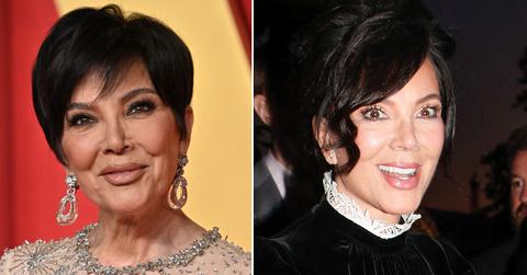 kris jenner facelift secrets pp