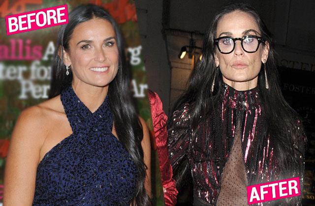 Demi Moore Face Scary Skinny Weight Loss