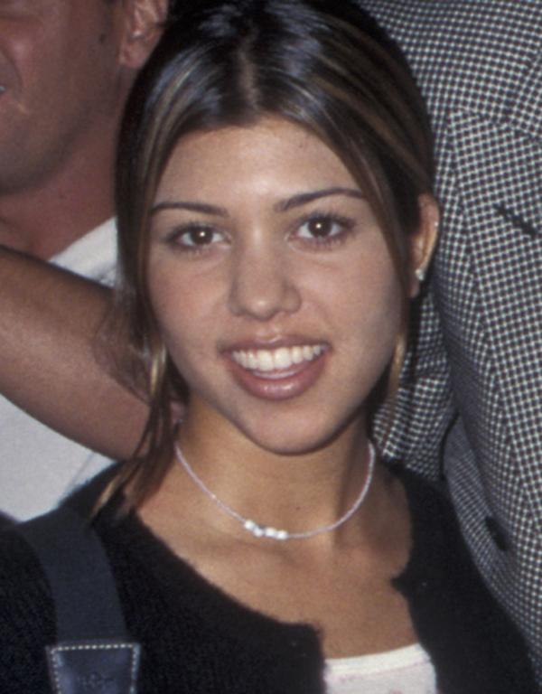 Kourtney Kardashian Plastic Surgery