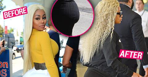 //Blac Chyna Butt Deflating Plastic Surgeon Doctors Claim Photos pp