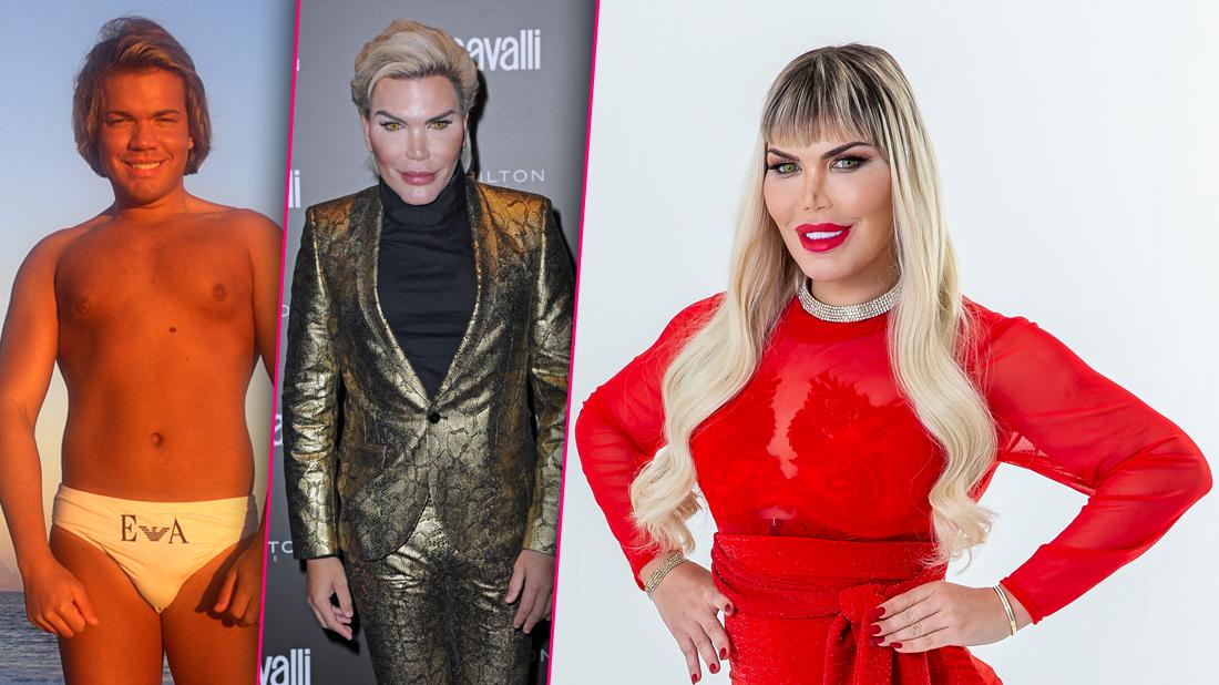 Human Doll Rodrigo Alves Has More Surgery