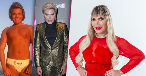 Human Ken Doll Wants Bones Around Eyes Shaved In Gender Transition Into Barbie