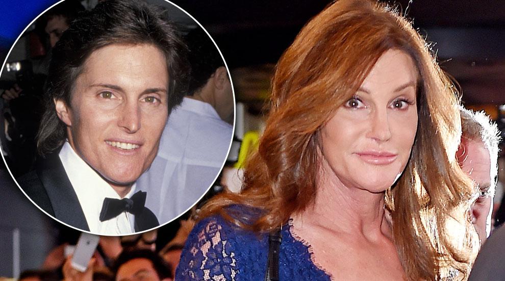 Caitlyn Jenner Beard Removed 1980s