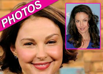 //ashley judd face injections