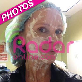 //tamra barney plastic surgery_ _