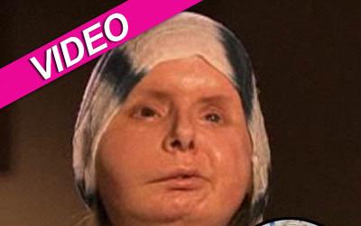 //charla nash new face video